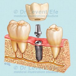 Dentistry (D)